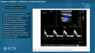 133
Doppler carótidas e vertebrais: considerações finais
Insuficiência aórtica
A presença de insuficiência
aórtica importante pode gerar
um duplo pico sistólico
chamado pulso bisferiens, ou
ainda a ausência de fluxo
diastólico ou fluxo diastólico
reverso, em especial nas
artérias carótidas comuns,
podendo comprometer a
avaliação das velocidades e
relações, em especial as que
envolvam a VDF.
 