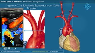 Origem ACC e Subclávia Esquerdas com Collor
Doppler
bases para o exame – Anatomia ecográfica
Dr. Carlos Stéfano Hoffmann Britto @drcarlosstefano stefanobritto@hotmail.com (31) 98799-0405
 