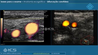 bases para o exame – Anatomia ecográfica – bifurcação carotídea
Dr. Carlos Stéfano Hoffmann Britto @drcarlosstefano stefanobritto@hotmail.com (31) 98799-0405
 