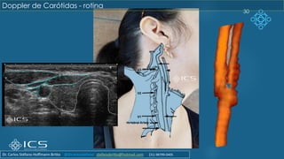 30
Doppler de Carótidas - rotina
Dr. Carlos Stéfano Hoffmann Britto @drcarlosstefano stefanobritto@hotmail.com (31) 98799-0405
 