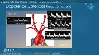 Doppler de Carótidas Registro mínimo
37
Doppler de Carótidas – rotina – anatomia ecográfica
Dr. Carlos Stéfano Hoffmann Britto @drcarlosstefano stefanobritto@hotmail.com (31) 98799-0405
 