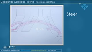 Steer
39
Doppler de Carótidas – rotina – técnica ecográfica
Dr. Carlos Stéfano Hoffmann Britto @drcarlosstefano stefanobritto@hotmail.com (31) 98799-0405
 