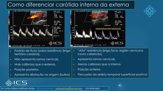 Como diferenciar carótida interna da externa
➢ Padrão de fluxo: baixa resistência (Irriga
território cerebral).
➢ Não apresenta ramos cervicais.
➢ Mais calibrosa que a externa.
➢ Posição posterior.
➢ Apresenta dilatação na origem (bulbo)
➢ “Alta” resistência (Irriga face, região cervical e
couro cabeludo).
➢ Apresenta ramos cervicais.
➢ Menos calibrosa que a interna.
➢ Posição anterior.
➢ Percussão da artéria temporal superficial positivo!
40
Dr. Carlos Stéfano Hoffmann Britto @drcarlosstefano stefanobritto@hotmail.com (31) 98799-0405
 