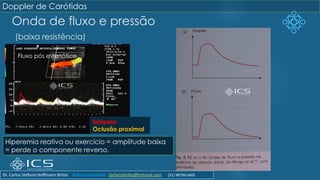 Onda de fluxo e pressão
(baixa resistência)
Hiperemia reativa ou exercício = amplitude baixa
= perde o componente reverso.
Fluxo pós estenótico
Erisipela
Oclusão proximal
Doppler de Carótidas
Dr. Carlos Stéfano Hoffmann Britto @drcarlosstefano stefanobritto@hotmail.com (31) 98799-0405
 