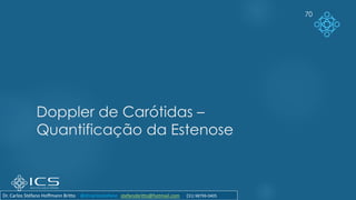 70
Doppler de Carótidas –
Quantificação da Estenose
Dr. Carlos Stéfano Hoffmann Britto @drcarlosstefano stefanobritto@hotmail.com (31) 98799-0405
 