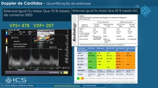VPS= 478 VDF= 207
73
Estenose Igual Ou Maior Que 70 % tabela
de consenso 2003
Doppler de Carótidas – Quantificação da estenose
Estenose Igual Ou Maior Que 90 % tabela DIC
Dr. Carlos Stéfano Hoffmann Britto @drcarlosstefano stefanobritto@hotmail.com (31) 98799-0405
 