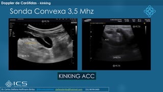 Sonda Convexa 3,5 Mhz
KINKING ACC
Doppler de Carótidas – kinking
Dr. Carlos Stéfano Hoffmann Britto @drcarlosstefano stefanobritto@hotmail.com (31) 98799-0405
 