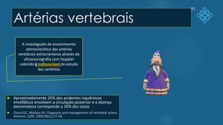 Artérias vertebrais
91
A investigação de envolvimento
aterosclerótico das artérias
vertebrais extracranianas através da
ultrassonografia com Doppler
colorido é indissociável do estudo
das carótidas
 Aproximadamente 25% dos acidentes isquêmicos
encefálicos envolvem a circulação posterior e a doença
ateromatosa corresponde a 20% dos casos
 Cloud GC, Markus HS. Diagnosis and management of vertebral artery
stenosis. QJM. 2003;96(1):27-54.
 