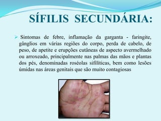  Manifestação: Relacionada à queda das defesas imunológicas do organismo.