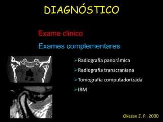 DIAGNÓSTICO

Exame clinico
Exames complementares
          Radiografia panorâmica
          Radiografia transcraniana
          Tomografia computadorizada
          IRM



                               Okeson J. P., 2000
 