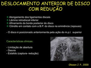 DESLOCAMENTO ANTERIOR DE DISCO
         COM REDUÇÃO
  Alongamento dos ligamentos discais
  Lâmina retrodiscal inferior
  Afinamento da borda posterior do disco
  Côndilo em contato com a B.P. do disco na eminência (repouso)

 - O disco é posicionado anteriormente pela ação do m.p.l. superior


 Características clínicas:

 - Limitação de abertura
 - Desvio
 - Estalido (captura- redução)



                                                       Okeson J. P., 2000
 