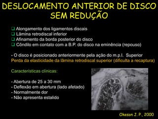 DESLOCAMENTO ANTERIOR DE DISCO
         SEM REDUÇÃO
  Alongamento dos ligamentos discais
  Lâmina retrodiscal inferior
  Afinamento da borda posterior do disco
  Côndilo em contato com a B.P. do disco na eminência (repouso)

 - O disco é posicionado anteriormente pela ação do m.p.l. Superior
 Perda da elasticidade da lâmina retrodiscal superior (dificulta a recaptura)

 Características clínicas:

 - Abertura de 25 a 30 mm
 - Deflexão em abertura (lado afetado)
 - Normalmente dor
 - Não apresenta estalido


                                                          Okeson J. P., 2000
 