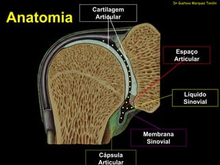Dr Gustavo Marques Tondin

           Cartilagem
Anatomia    Articular




                                    Espaço
                                    Articular




                                       Líquido
                                       Sinovial




                        Membrana
                         Sinovial

            Cápsula
            Articular
 