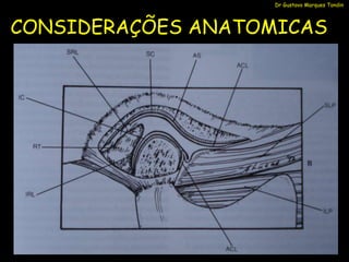 Dr Gustavo Marques Tondin



CONSIDERAÇÕES ANATOMICAS
 