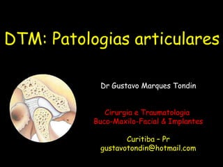 DTM: Patologias articulares

            Dr Gustavo Marques Tondin


              Cirurgia e Traumatologia
           Buco-Maxilo-Facial & Implantes

                   Curitiba – Pr
            gustavotondin@hotmail.com
 
