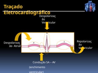 Traçado
Eletrocardiográfico
Repolarizaç
ão
Ventricular
Despolarizaç
ão Atrial
Condução SA – AV
(enchimento
ventricular)
Despolarizaç
ão
Ventricular
 