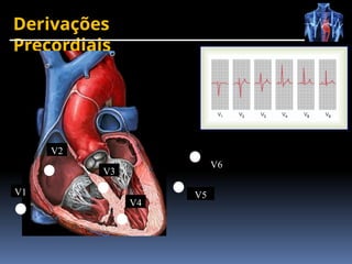 Derivações
Precordiais
V5
V3
V4
V6
V2
V1
 