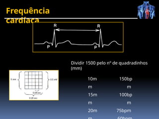Frequência
cardíaca
Dividir 1500 pelo nº de quadradinhos
(mm)
10m
m
15m
m
20m
150bp
m
100bp
m
75bpm
 