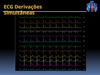 ECG Derivações
Simultâneas
 