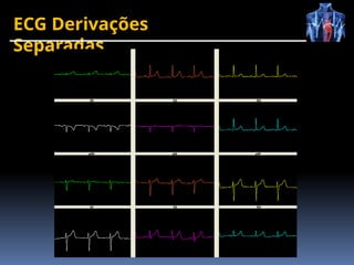 ECG Derivações
Separadas
 