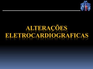 ALTERAÇÕES
ELETROCARDIOGRAFICAS
 