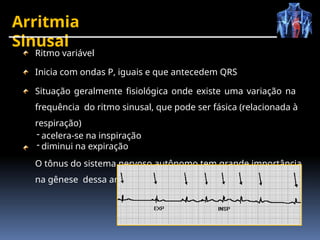Arritmia
Sinusal
Ritmo variável
Inicia com ondas P, iguais e que antecedem QRS
Situação geralmente fisiológica onde existe uma variação na
frequência do ritmo sinusal, que pode ser fásica (relacionada à
respiração)
- acelera-se na inspiração
- diminui na expiração
O tônus do sistema nervoso autônomo tem grande importância
na gênese dessa arritmia
 