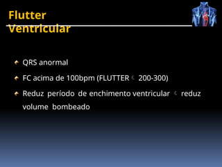 Flutter
Ventricular
QRS anormal
FC acima de 100bpm (FLUTTER 200-300)
Reduz período de enchimento ventricular  reduz
volume bombeado
 