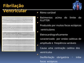 Fibrilação
Ventricular Ritmo variável
Batimentos acima do limite do
FLUTTER
Produzido por muitos focos ectópicos
ventriculares
Eletrocardiograficamente
caracterizado por ondas caóticas de
amplitude e freqüência variáveis
Causa uma contração caótica dos
ventrículos
Desfibrilação obrigatória  inibe
focos ectópicos
 