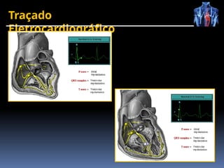 Traçado
Eletrocardiográfico
 