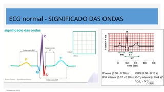 ECG normal - SIGNIFICADO DAS ONDAS
*pode aparecer onda U
 