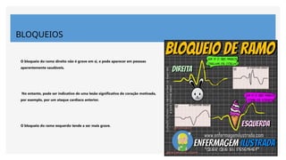 BLOQUEIOS
O bloqueio do ramo direito não é grave em si, e pode aparecer em pessoas
aparentemente saudáveis.
No entanto, pode ser indicativo de uma lesão significativa do coração motivada,
por exemplo, por um ataque cardíaco anterior.
O bloqueio do ramo esquerdo tende a ser mais grave.
 