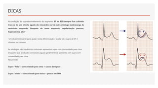 DICAS
Na avaliação do supradesnivelamento do segmento ST no ECG sempre fica a dúvida:
trata-se de um infarto agudo do miocárdio ou há outra etiologia (sobrecarga de
ventrículo esquerdo, bloqueio de ramo esquerdo, repolarização precoce,
hipercalemia, etc)?
Um dica interessante para ajudar nesta diferenciação é avaliar se o supra de ST é
côncavo ou convexo.
As etiologias não isquêmicas costumam apresentar supra com concavidade para cima
enquanto que a oclusão coronariana aguda geralmente se apresenta com supra com
convexidade para cima.
Resumindo:
Supra “feliz” = concavidade para cima = causas benignas
Supra “triste” = concavidade para baixo = pensar em IAM
 