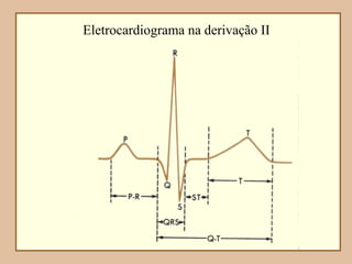 Eletrocardiograma na derivação II
 