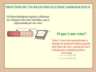 PRINCÍPIO DE UM REGISTRO ELETROCARDIOGRÁFICO
O Eletrocradiógrafo registra a diferença
de voltagem entre dois eletródios, que é
representada por um vetor
O que é um vetor?
Vetor: é uma seta apontada para a
direção do potencial elétrico gerado
pelo fluxo de íons; a ponta da seta é
voltada para a direção positiva.
- - - - + + +
- - - - + + +
 