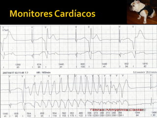    Monitores Holter ou Ambulatorial;




   Monitores de Evento.
 