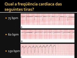    75 bpm



   60 bpm



   150 bpm
 