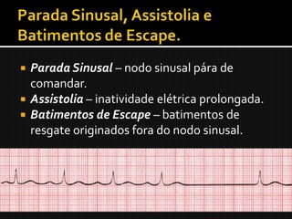 Parada Sinusal – nodo sinusal pára de
  comandar.
 Assistolia – inatividade elétrica prolongada.
 Batimentos de Escape – batimentos de
  resgate originados fora do nodo sinusal.
 