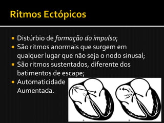  Distúrbio de formação do impulso;
 São ritmos anormais que surgem em
  qualquer lugar que não seja o nodo sinusal;
 São ritmos sustentados, diferente dos
  batimentos de escape;
 Automaticidade
  Aumentada.
 