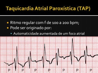    Ritmo regular com f de 100 a 200 bpm;
   Pode ser originado por:
     Automaticidade aumentada de um foco atrial
      ectópico (per. de aquecimento→RI→per. resfr.)
     Circuito reentrante dentro dos átrios (início
      abrupto com um batimento atrial prematuro)
   Como pode diferenciar uma TAP de uma
    TSVP?
 