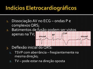1. Dissociação AV no ECG – ondas P e
   complexos QRS;
2. Batimentos de fusão podem ser vistos
   apenas na TV; sinusal BF
                               CVP
                                                  sinusal




3.    Deflexão inicial do QRS:
     1. TSVP com aberrância – freqüentemente na
        mesma direção;
     2. TV – pode estar na direção oposta
 