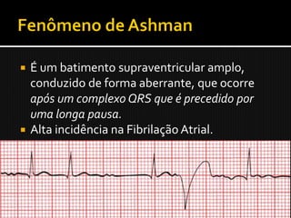  É um batimento supraventricular amplo,
  conduzido de forma aberrante, que ocorre
  após um complexo QRS que é precedido por
  uma longa pausa.
 Alta incidência na Fibrilação Atrial.
 