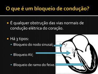    É qualquer obstrução das vias normais de
    condução elétrica do coração.

   Há 3 tipos:
     Bloqueio do nodo sinusal;

     Bloqueio AV;

     Bloqueio de ramo do feixe.
 