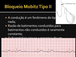  A condução é um fenômeno do tipo tudo-ou-
  nada;
 Razão de batimentos conduzidos para
  batimentos não-conduzidos é raramente
  constante;
 O diagnóstico requer a presença de um
  batimento não conduzido, sem progressivo
  alargamento do intervalo PR.
 