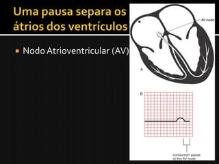    Nodo Atrioventricular (AV)
 