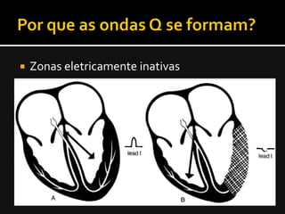    Zonas eletricamente inativas
 