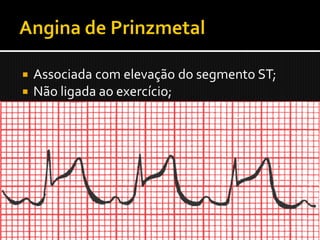    Associada com elevação do segmento ST;
   Não ligada ao exercício;
   Espasmo coronariano;
   SST – lesão transmural reversível;
   Não tem aparência arredondada;
   Retornam à linha basal após medicação
    antianginosa (p. ex. nitroglicerina).
 