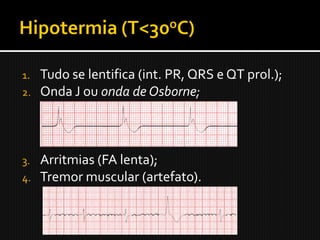 1.   Tudo se lentifica (int. PR, QRS e QT prol.);
2.   Onda J ou onda de Osborne;



3.   Arritmias (FA lenta);
4.   Tremor muscular (artefato).
 