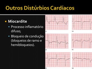    Miocardite
     Processo inflamatório
      difuso;
     Bloqueio de condução
      (bloqueios de ramo e
      hemibloqueios).
 