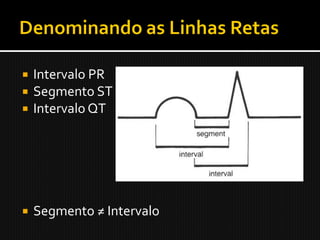   Intervalo PR
   Segmento ST
   Intervalo QT




   Segmento ≠ Intervalo
 
