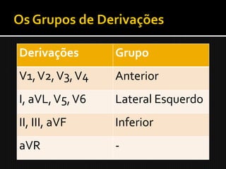 Derivações       Grupo
V1, V2, V3, V4   Anterior
I, aVL, V5, V6   Lateral Esquerdo
II, III, aVF     Inferior
aVR              -
 